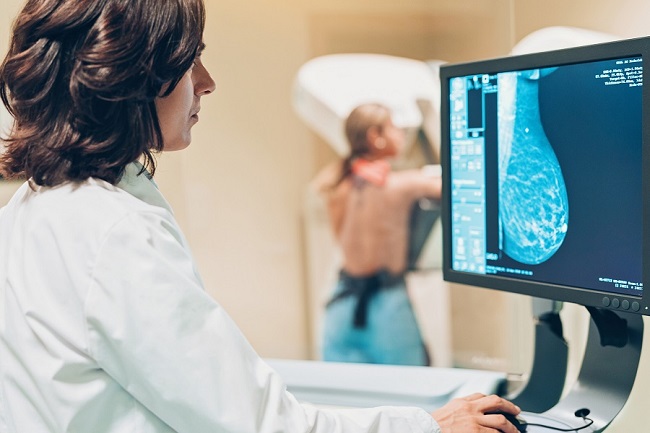 Time For Your Mammogram: What You Need to Know