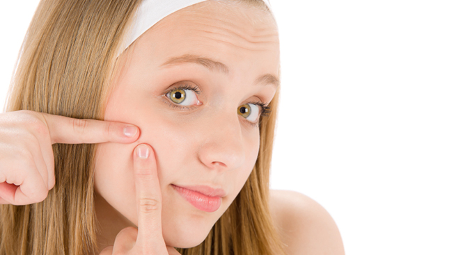 5 Acne Myths Busted