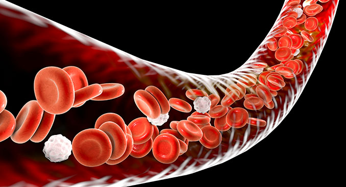 4 Blood Disorders and How to Treat Them