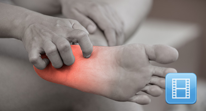 Doctor on Call: Neuropathy and Type 2 Diabetes