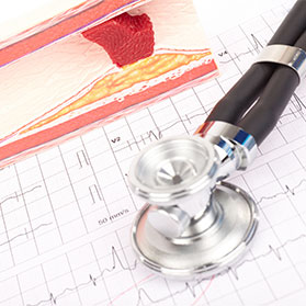 Kevin Receives an Unexpected Diagnosis at Age 43