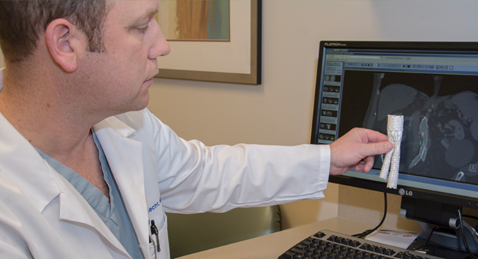 Gut Check: Leading the Way with Minimally Invasive Abdominal Aortic Aneurysm Surgery