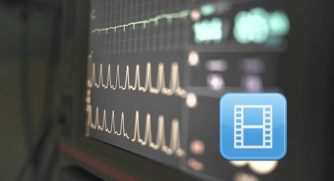 In a Heartbeat: Diane's Story of Surviving a Heart Attack