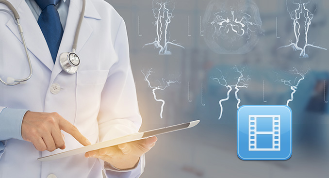 Doctor on Call: The Importance of Immediate and Comprehensive Stroke Care