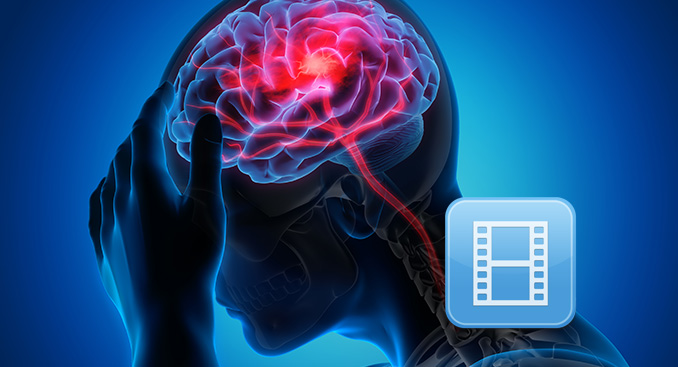 Health Talk Live: Increased Risk Of Stroke During COVID-19 | TriHealth