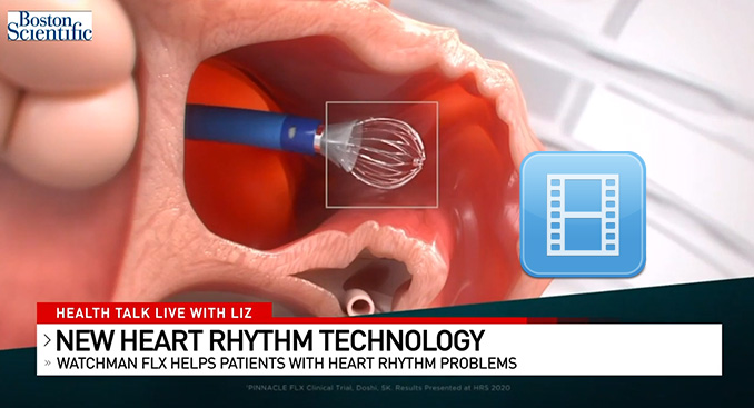 Health Talk Live: New Heart Rhythm Technology with WATCHMAN FLX