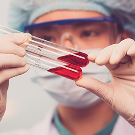 Ebola: Should I be Worried?