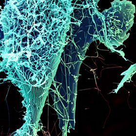 The Ebola Virus: What’s the No. 1 Thing You Should Know?