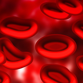 Do I Have Iron-Deficiency Anemia?