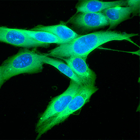 New DNA Immunotherapy for Melanoma Cancer: Is it Effective?