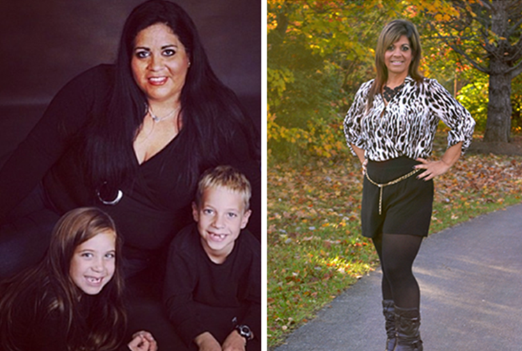 For Carolyn Williamson, gastric surgery has been a “life-changer”