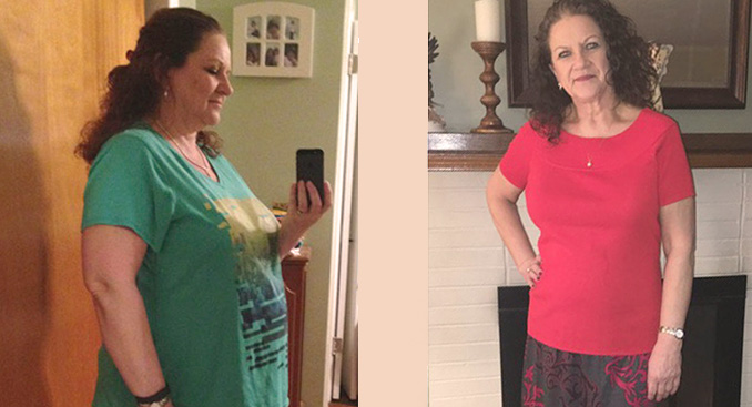 Life after Gastric Bypass: Happier, Healthier