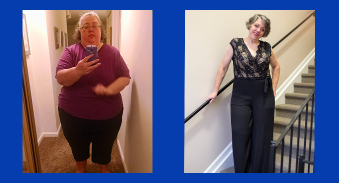 Sharon's Life Changing Surgery