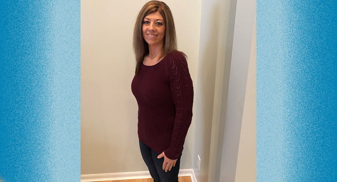 Breast Lift and Tummy Tuck Boost Confidence after Weight Loss