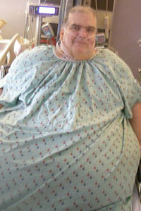 weight loss surgery options