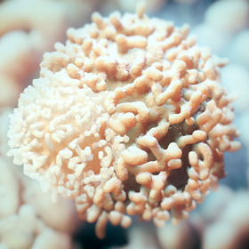 Women Need to Know About This Unique Type of Breast Cancer