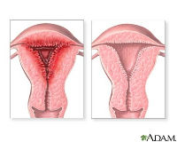 Abnormal Menstrual Periods