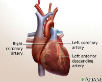 ADAM_-_heart_bypass_surgery_-_series_200x
