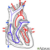 ADAM_-_heart_conditions_-_circulation_of_blood_through_the_heart_160x