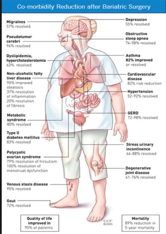co-morbidity reduction after bariatric surgery