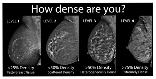 breast density