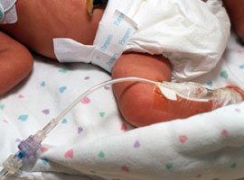 peripherally inserted central catheter
