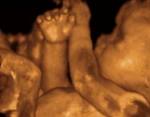4D-ultrasound-image 4D-ultrasound-image